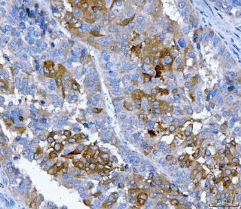 FGFR2 Antibody