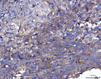 FGFR2 Antibody
