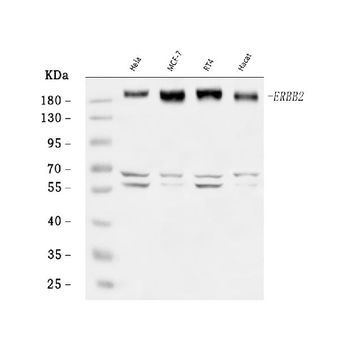 HER2/ERBB2 Antibody