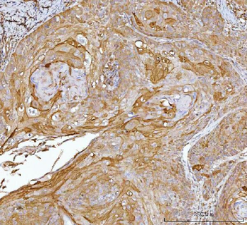 CRABP2 Antibody