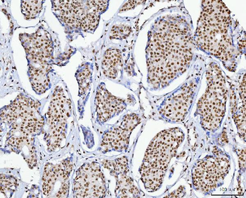 C1orf77/FOP/CHTOP Antibody
