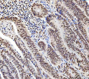 C1orf77/FOP/CHTOP Antibody