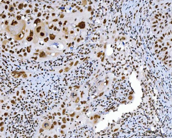 C1orf77/FOP/CHTOP Antibody