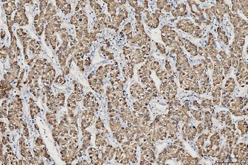 CES2 Rabbit Polyclonal Antibody