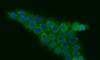 CCDC115 Rabbit Polyclonal Antibody