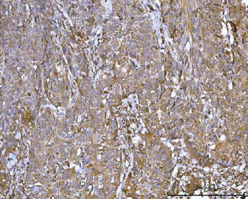 CCDC115 Rabbit Polyclonal Antibody