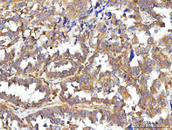 CCDC115 Rabbit Polyclonal Antibody