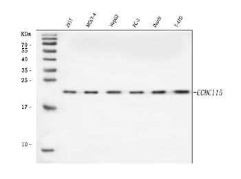 CCDC115 Rabbit Polyclonal Antibody
