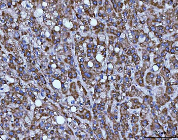 BBS9 Antibody