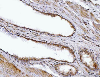 BBS9 Antibody