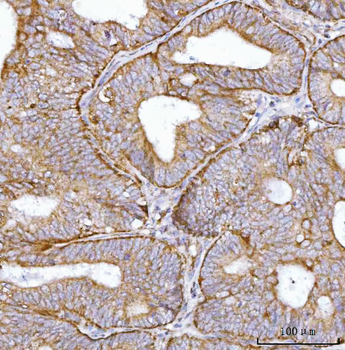 BBS9 Antibody