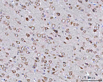 BBS9 Antibody