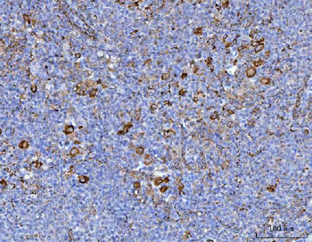 Axin 2/AXIN2 Antibody
