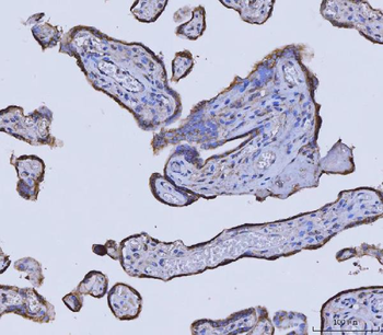 Glycine decarboxylase/GLDC Mouse Monoclonal Antibody