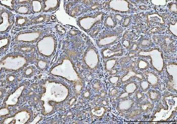Glycine decarboxylase/GLDC Mouse Monoclonal Antibody