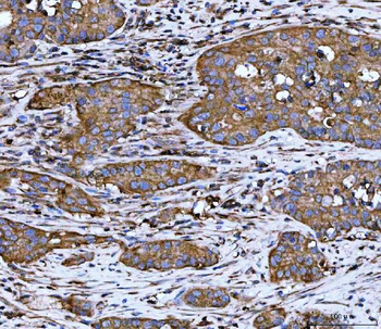 WDR1 Mouse Monoclonal Antibody