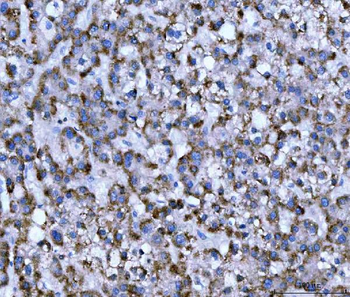 WDR1 Mouse Monoclonal Antibody
