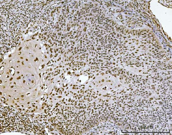 Ataxin 1 Antibody (monoclonal, 2B13G8)