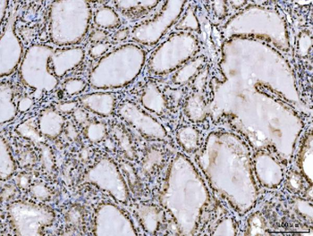Ataxin 1 Antibody (monoclonal, 2B13G8)