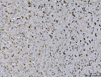 Ataxin 1 Antibody (monoclonal, 2B13G8)