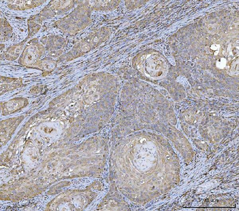 HLA-DR/HLA-DRA Antibody (monoclonal, 8I10H1)