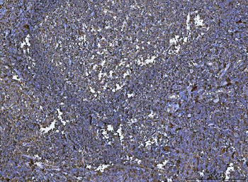 HLA-DR/HLA-DRA Antibody (monoclonal, 8I10H1)