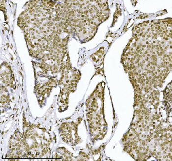 KPNB1 Antibody (monoclonal, 3I11F2)