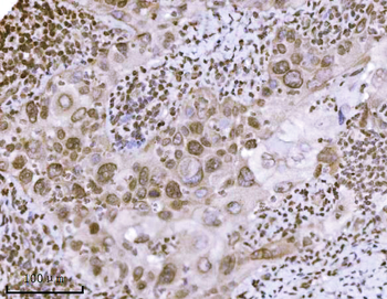 KPNB1 Antibody (monoclonal, 3I11F2)
