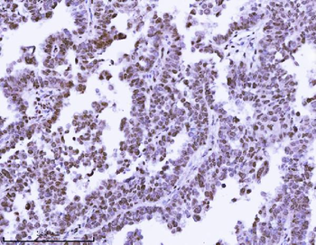 KPNB1 Antibody (monoclonal, 3I11F2)