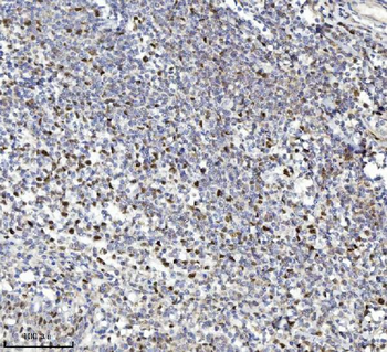 MCM7 Mouse Monoclonal Antibody