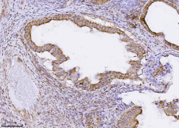 MPPB/PMPCB Mouse Monoclonal Antibody