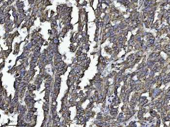 Drebrin/DBN1 Antibody (monoclonal, 4F6E7)