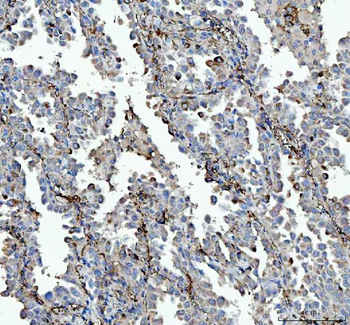 VPAC2/VIPR2 Rabbit Polyclonal Antibody