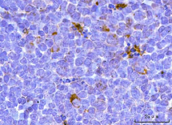 TFEB Antibody