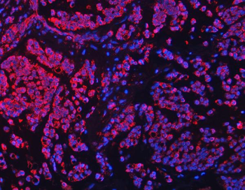 TFEB Antibody