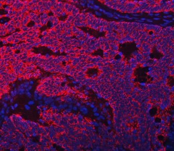 TFEB Antibody