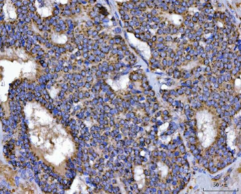 TFEB Antibody