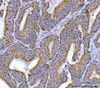 TFEB Antibody