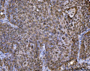 TRBP/TARBP2 Antibody
