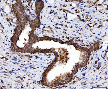 TRBP/TARBP2 Antibody