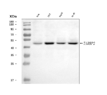 TRBP/TARBP2 Antibody