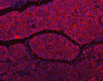 SLU7 Antibody