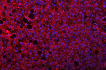 MSF/SEPTIN9 Antibody