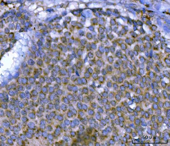 MSF/SEPTIN9 Antibody