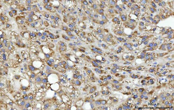 MSF/SEPTIN9 Antibody