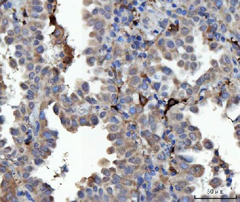 MSF/SEPTIN9 Antibody