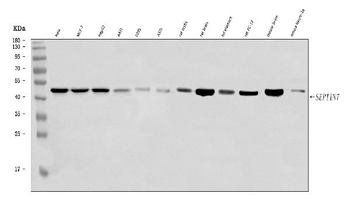 SEPT7/SEPTIN7 Antibody