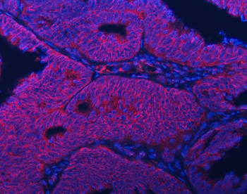 Septin 2/SEPTIN2 Antibody