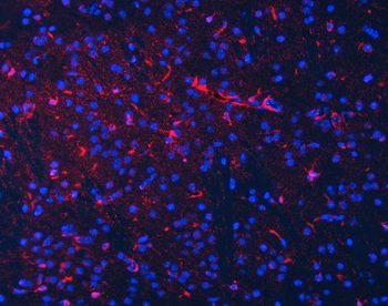 Septin 2/SEPTIN2 Antibody