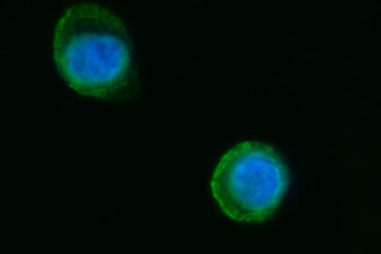 Septin 2/SEPTIN2 Antibody